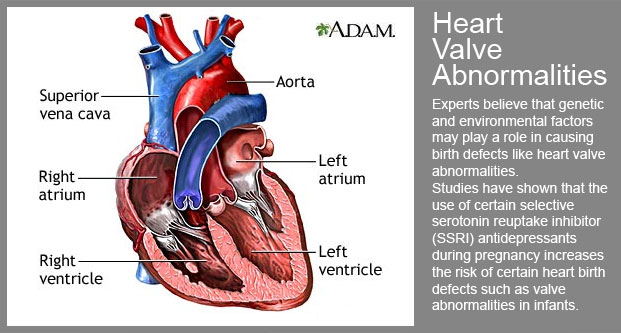 Studies have shown that the use of certain selective serotonin reuptake inhibitor antidepressants during pregnancy increases the risk of certain heart birth defects such as valve abnormalities.